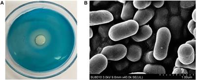 Purification, Characterization, and Hydrolysate Analysis of Dextranase From Arthrobacter oxydans G6-4B